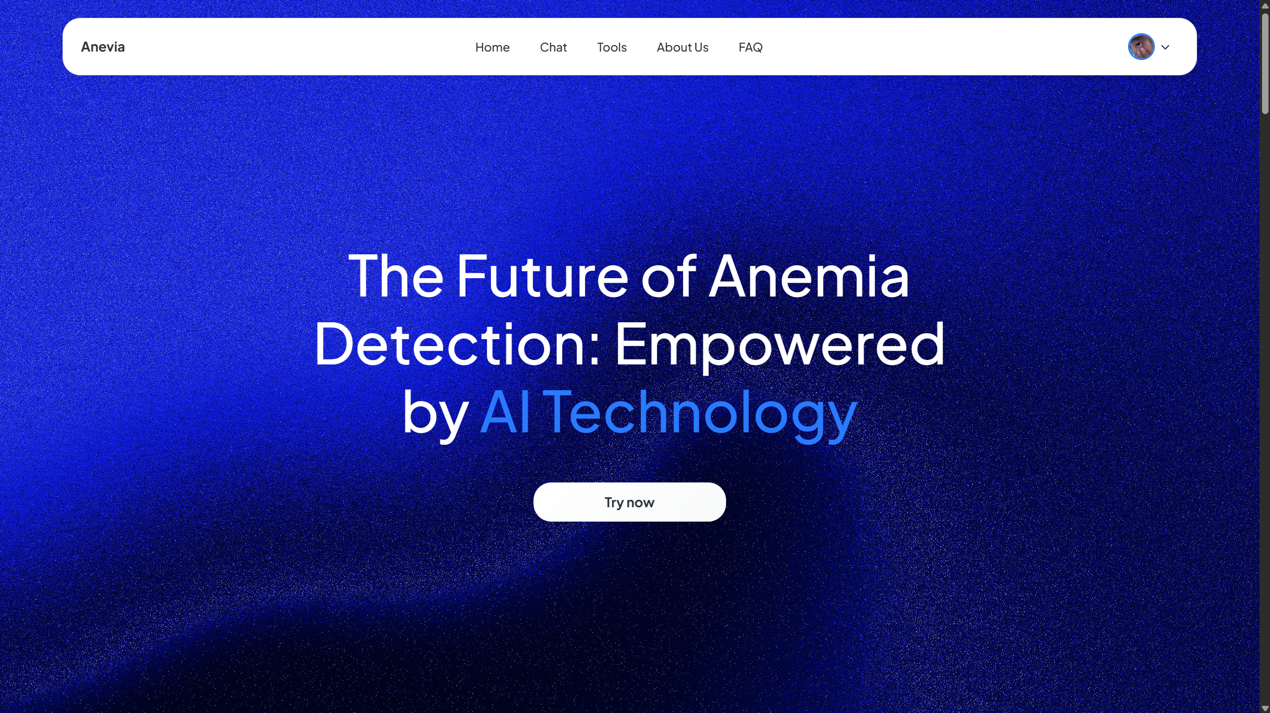 Anevia Backend Preview